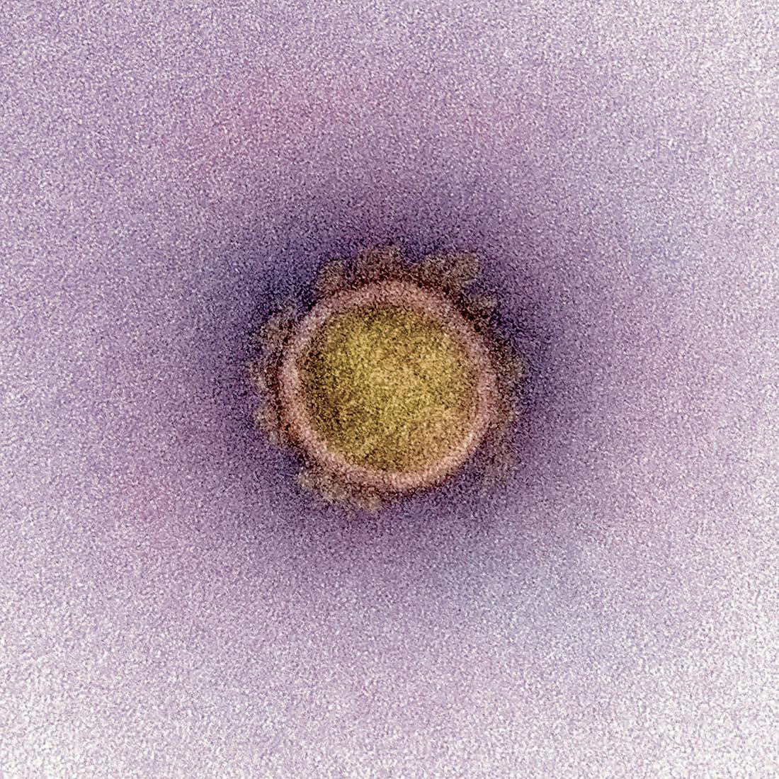 Numéro d'image 49 de la section actuelle de The Year of the Virus de Cosentino France